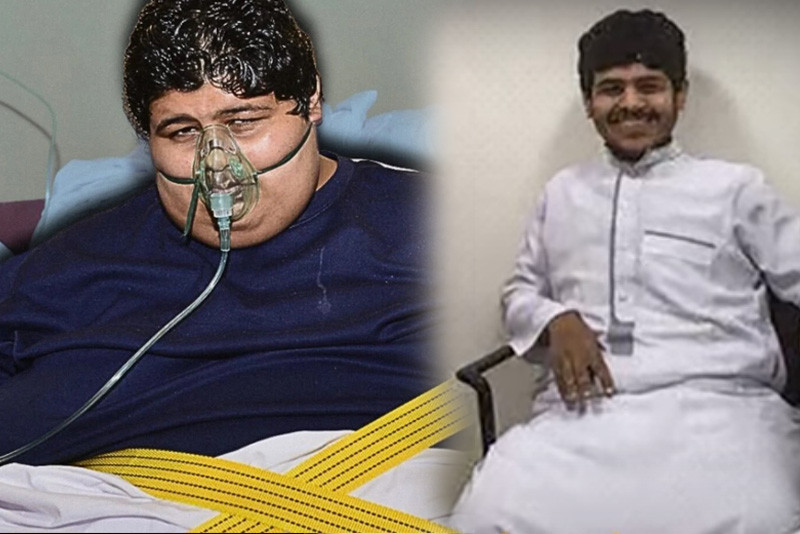 संसारकै मोटा खालिदले घटाए ५४६ किलो तौल, बने ‘स्माइलिङ म्यान’