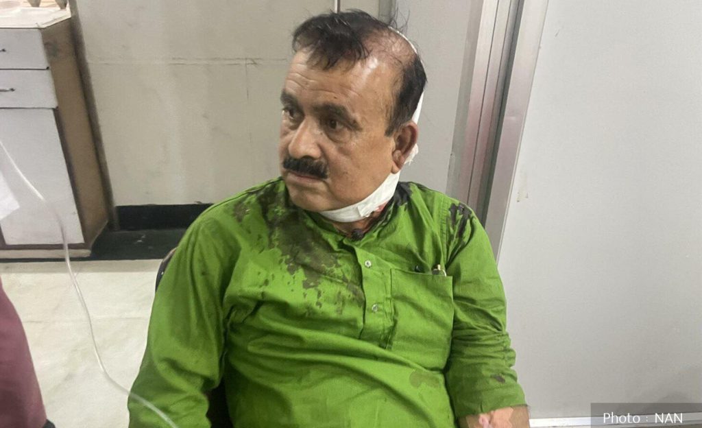 कांग्रेस सहमहामन्त्री महेन्द्र यादवको स्वास्थ्य अवस्था स्थिर : ट्रमा सेन्टर 