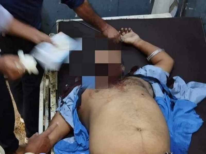 बारामा गोली चल्यो, प्रिन्सिपल घाइते  